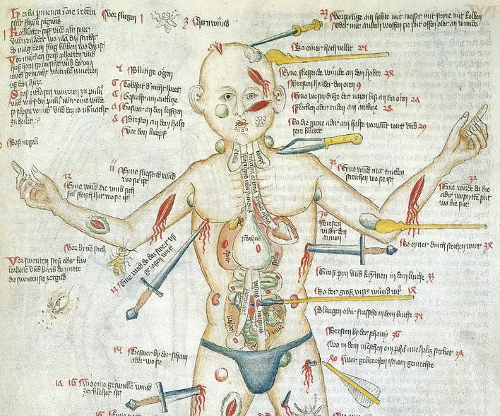 The Wound Man